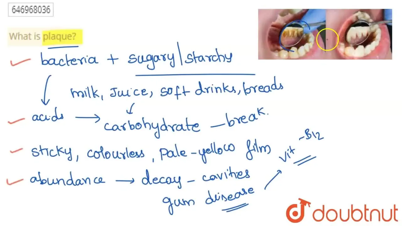 [Tamil Solution] What is plaque?