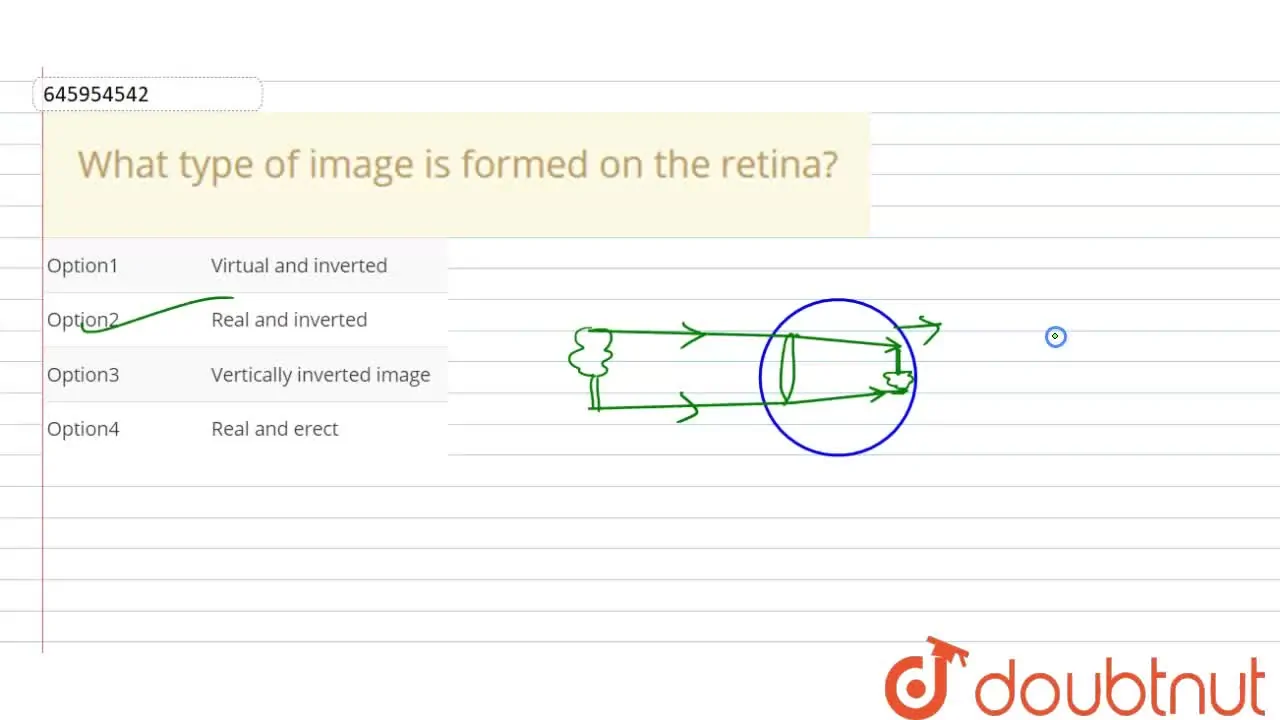 What type of image is formed on the retina?
