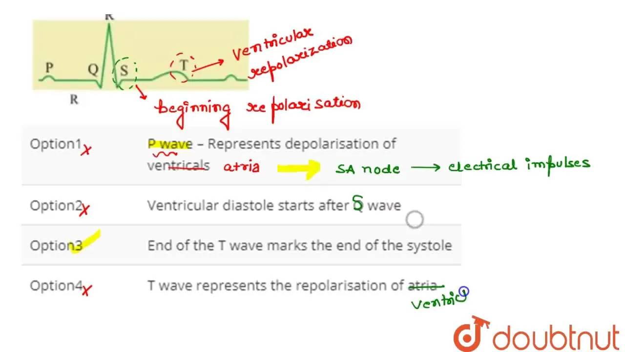 End of the T wave marks the end of the systole