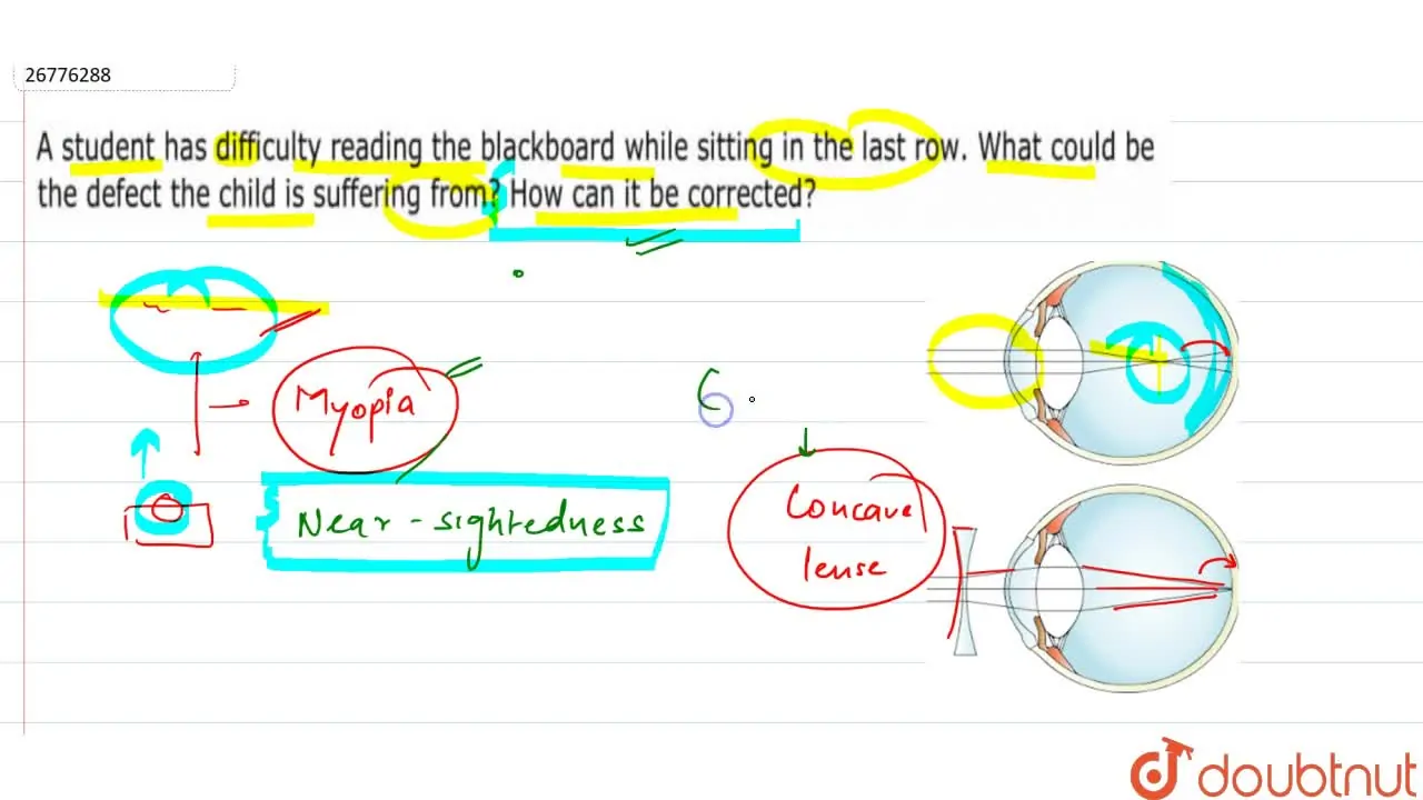 A student has difficulty reading the blackboard while sitting in the l