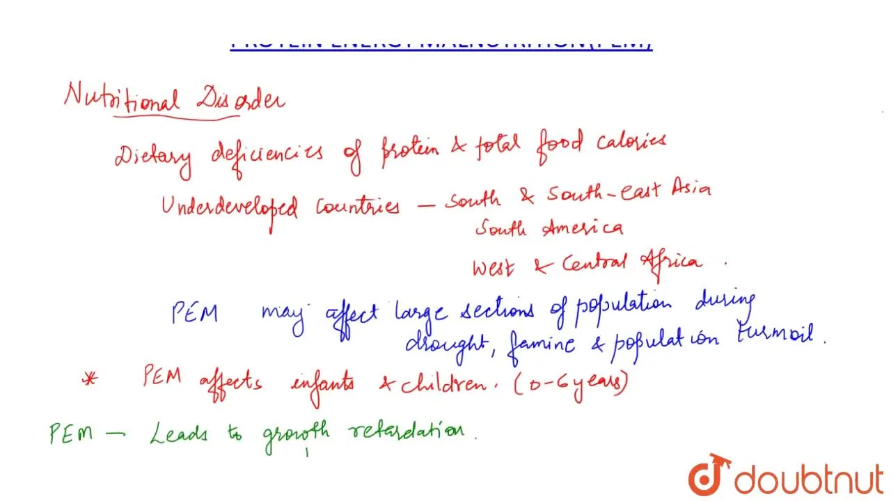 PROTEINENERGY MALNUTRITION(PEM)