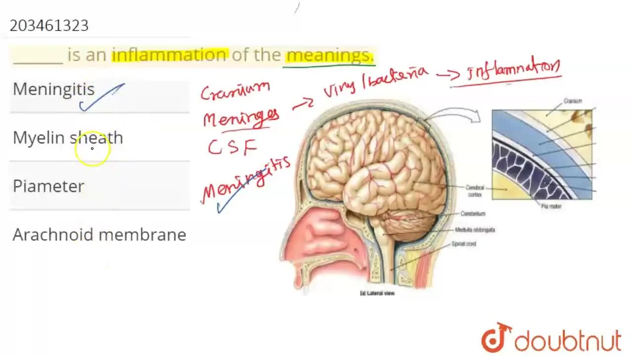 [Tamil Solution] is an inflammation of the meanings.