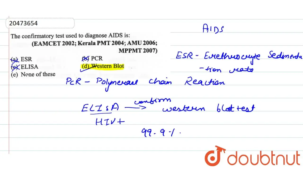 The confirmatory test used to diagnose AIDS is