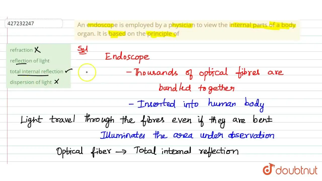 [Tamil] An endoscope is employed by a physician to view the internal p